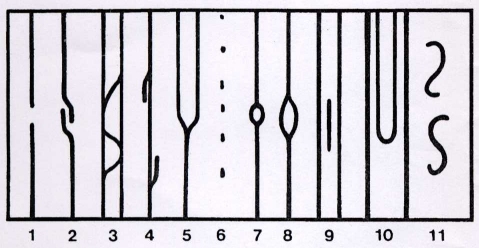 Merkmale im Verlauf der Papillarlinien